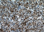 S100A4 Antibody in Immunohistochemistry (Paraffin) (IHC (P))