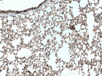 S100A4 Antibody in Immunohistochemistry (Paraffin) (IHC (P))