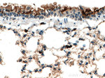 S100A4 Antibody in Immunohistochemistry (Paraffin) (IHC (P))