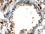 S100A4 Antibody in Immunohistochemistry (Paraffin) (IHC (P))