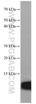 S100A4 Antibody in Western Blot (WB)