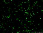 HRPT2/CDC73 Antibody in Immunohistochemistry (PFA fixed) (IHC (PFA))