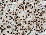 HRPT2/CDC73 Antibody in Immunohistochemistry (Paraffin) (IHC (P))