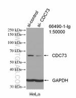 HRPT2/CDC73 Antibody in Western Blot (WB)