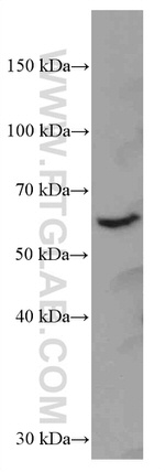 HRPT2/CDC73 Antibody in Western Blot (WB)