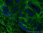 Periostin Antibody in Immunohistochemistry (PFA fixed) (IHC (PFA))