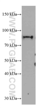 Periostin Antibody in Western Blot (WB)