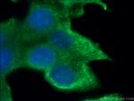 NRG1 Antibody in Immunocytochemistry (ICC/IF)