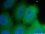 PKC iota Antibody in Immunocytochemistry (ICC/IF)