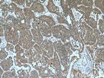 PKC iota Antibody in Immunohistochemistry (Paraffin) (IHC (P))