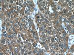 PKC iota Antibody in Immunohistochemistry (Paraffin) (IHC (P))