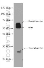 NR2E3 Antibody in Western Blot (WB)