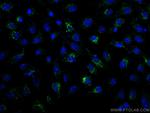 Calretinin Antibody in Immunocytochemistry (ICC/IF)