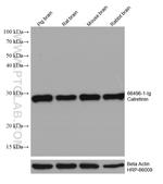 Calretinin Antibody in Western Blot (WB)