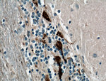 Calretinin Antibody in Immunohistochemistry (Paraffin) (IHC (P))