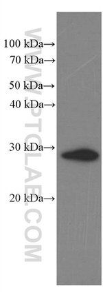 Calretinin Antibody in Western Blot (WB)