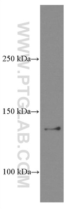 CCAR2 Antibody in Western Blot (WB)