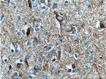 TAU Antibody in Immunohistochemistry (Paraffin) (IHC (P))