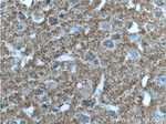 TAU Antibody in Immunohistochemistry (Paraffin) (IHC (P))