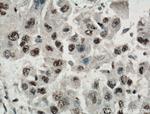 TAZ Antibody in Immunohistochemistry (Paraffin) (IHC (P))