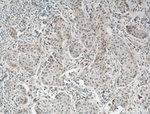 TAZ Antibody in Immunohistochemistry (Paraffin) (IHC (P))