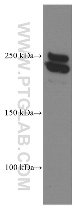 CNOT1 Antibody in Western Blot (WB)