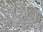 SP1 Antibody in Immunohistochemistry (Paraffin) (IHC (P))