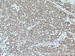 SP1 Antibody in Immunohistochemistry (Paraffin) (IHC (P))