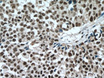 SP1 Antibody in Immunohistochemistry (Paraffin) (IHC (P))