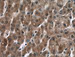 F2 Antibody in Immunohistochemistry (Paraffin) (IHC (P))