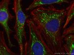 PYCR1 Antibody in Immunocytochemistry (ICC/IF)