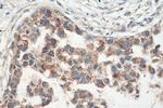 PYCR1 Antibody in Immunohistochemistry (Paraffin) (IHC (P))