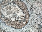 MDM2 Antibody in Immunohistochemistry (Paraffin) (IHC (P))