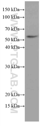 MDM2 Antibody in Western Blot (WB)