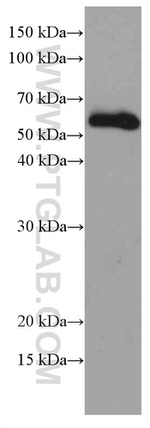 MDM2 Antibody in Western Blot (WB)