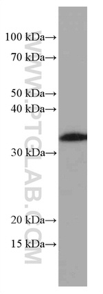 OLIG2 Antibody in Western Blot (WB)