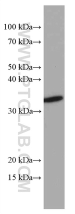 OLIG2 Antibody in Western Blot (WB)