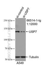 USP7 Antibody in Western Blot (WB)