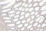 SMAD3 Antibody in Immunohistochemistry (Paraffin) (IHC (P))