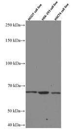 MKS1 Antibody in Western Blot (WB)