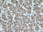 MKS1 Antibody in Immunohistochemistry (Paraffin) (IHC (P))