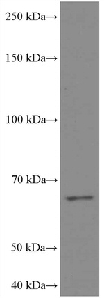 MKS1 Antibody in Western Blot (WB)