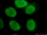 PARP1 Antibody in Immunocytochemistry (ICC/IF)