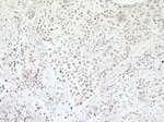 PARP1 Antibody in Immunohistochemistry (Paraffin) (IHC (P))