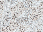 HMGB1 Antibody in Immunohistochemistry (Paraffin) (IHC (P))