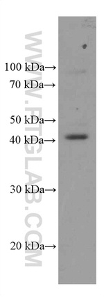 FCGR2A / CD32a Antibody in Western Blot (WB)