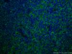 HLA-E Antibody in Immunohistochemistry (PFA fixed) (IHC (PFA))