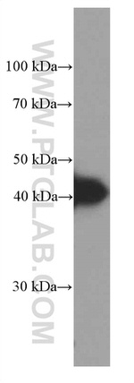 HLA-E Antibody in Western Blot (WB)