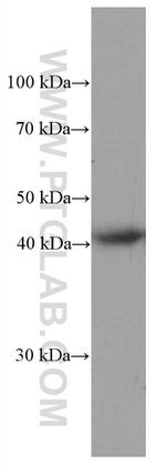 HLA-E Antibody in Western Blot (WB)