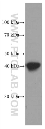 HLA-E Antibody in Western Blot (WB)